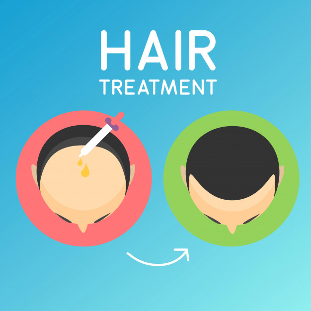 Hair Transplant Candidates- Who is the best candidate for Hair Transplant?