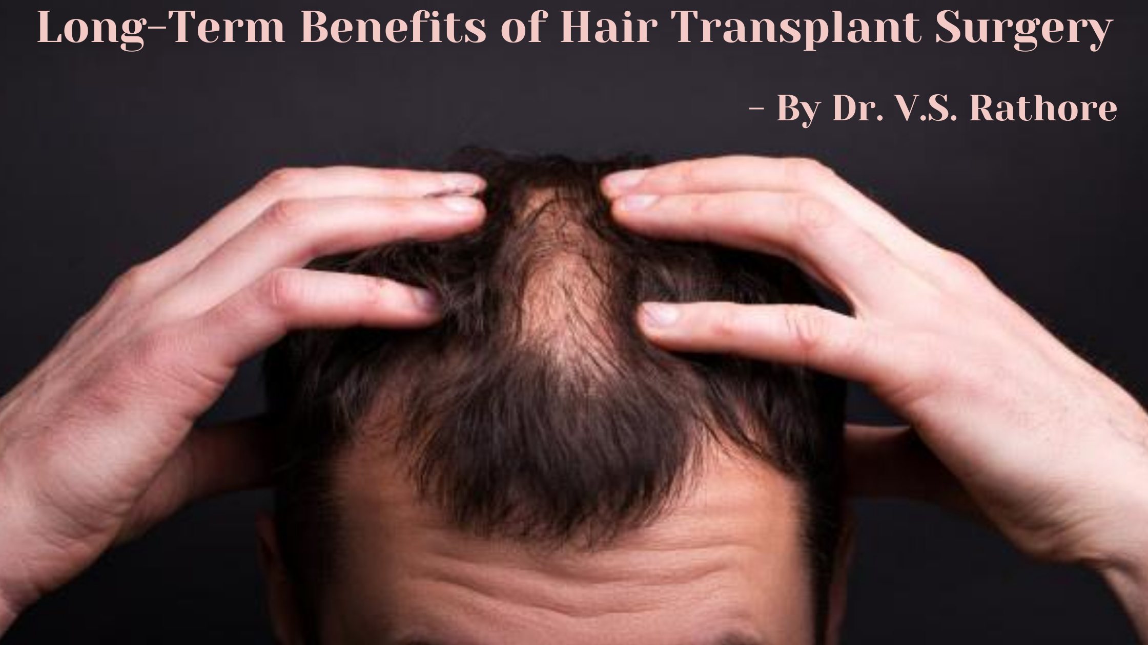 Long-Term Benefits of Hair Transplant Surgery