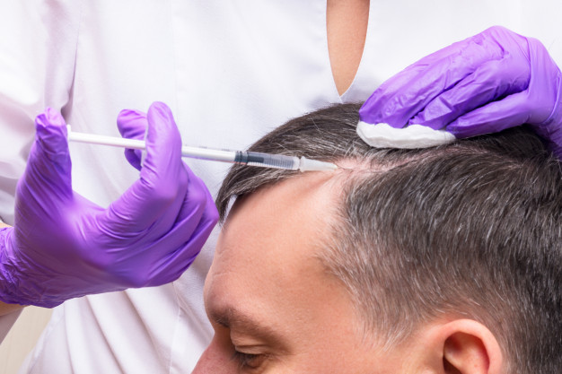 We are going to look at a comprehensive history of hair transplant. Let us start with Hair Transplant Surgery: A chronology.