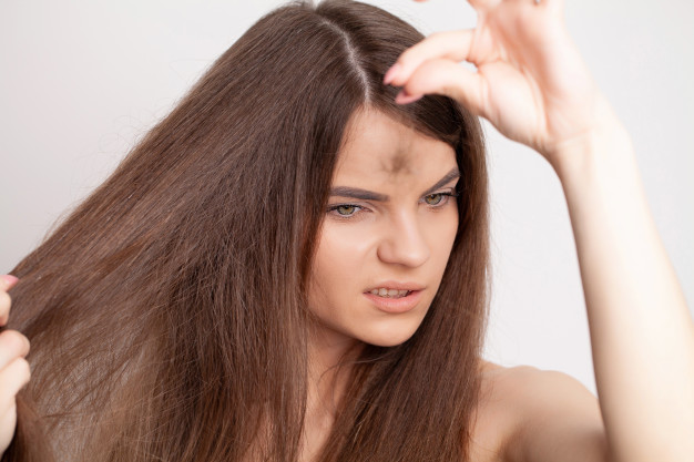 Androgenic Alopecia In Women