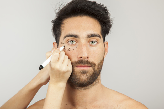 Is Eyebag Surgery Permanent?