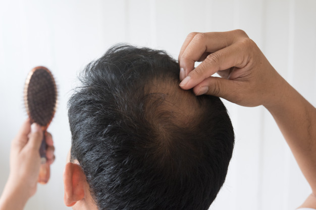 Can Hair Loss Indicate Some Disease?