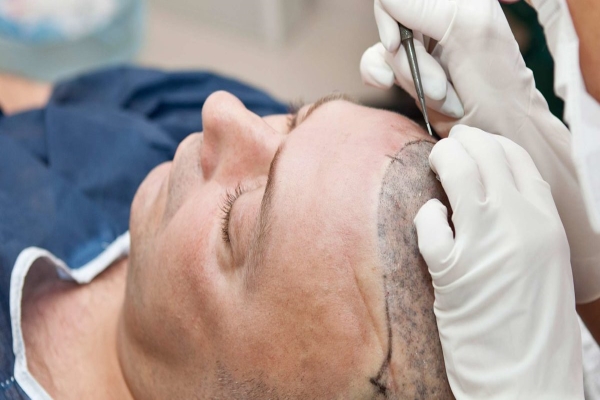 Qualities of a hair transplant surgeon