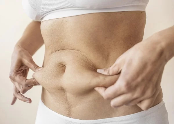 What you need to know about liposuction