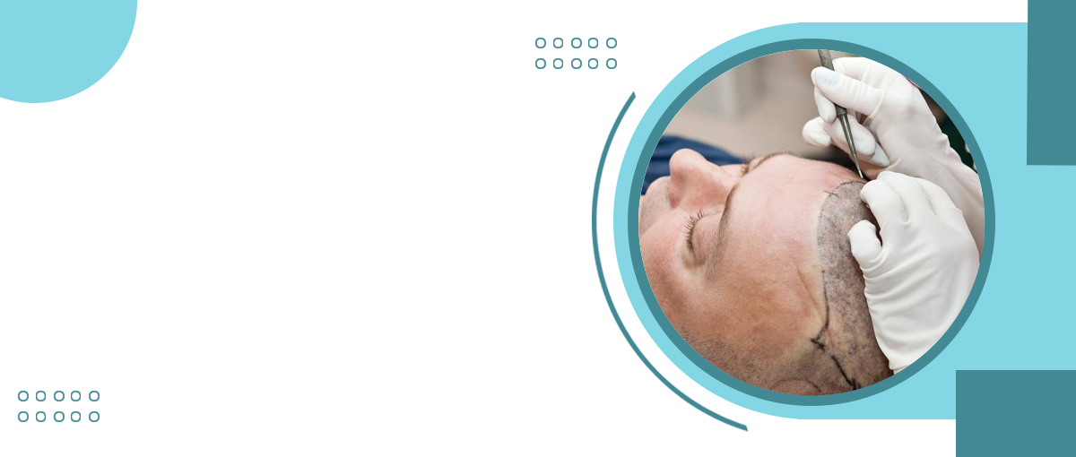<span>Hair Transplant clinic</span> in Kolkata