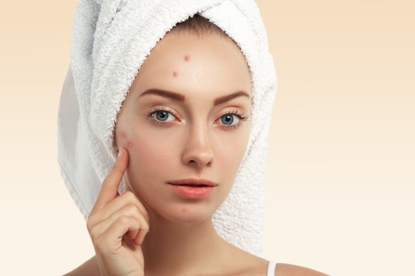 Pimple Removal Treatment In Kolkata: Are They Worth Opting For?