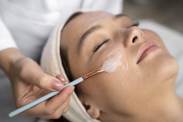 Woman receiving Chemical Peels for Hyperpigmentation